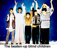 images/blind1.jpg